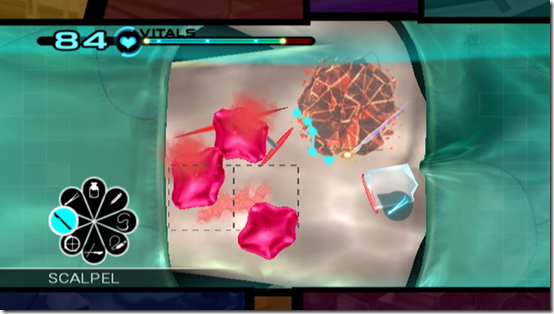 traumateam_screens_surgery_03